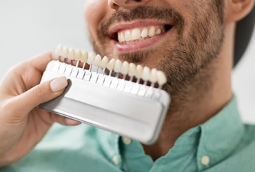 Whitening Services