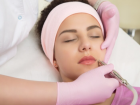 Revitalize Your Complexion: The Wonders of RF Needling, Hydrodermabrasion, and Skin Peels