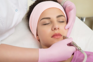 Revitalize Your Complexion: The Wonders of RF Needling, Hydrodermabrasion, and Skin Peels